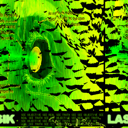LASIK